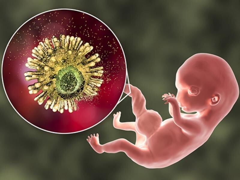 CMV Infection Therapeutics Market Set to Soar on Biotech
Innovation





The Cytomegalovirus (CMV) I...