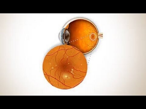 Metastatic Prostate Cancer Market Is Estimated to Witness
High Growth Owing to Innovative Therapeuti...