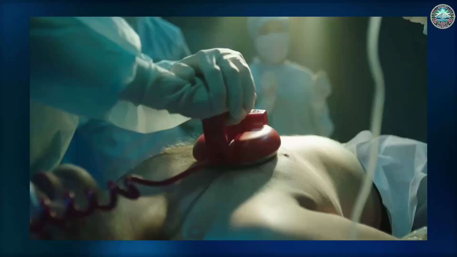 有史以来规模第二大的COVID-19疫苗安全性研究——比较了4600万接种者与4000万未接种者——发现以下风险大幅增加：

 心脏病：第二剂后风险增加286%
 中风：第一剂后风险增加240%
 冠...