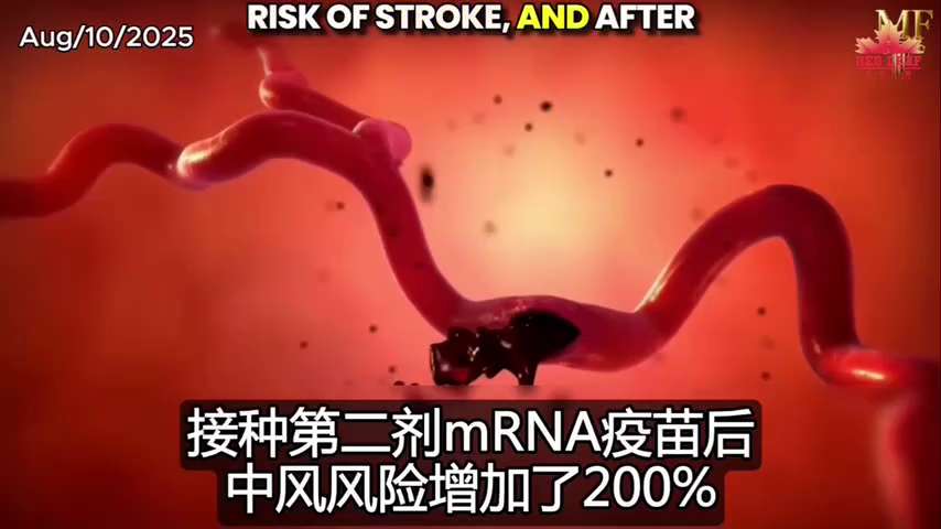 mRNA Vaccines Cause Brain Damage!

mRNA vaccines cause brain damage, 86 neuropsychiatric disorders s...