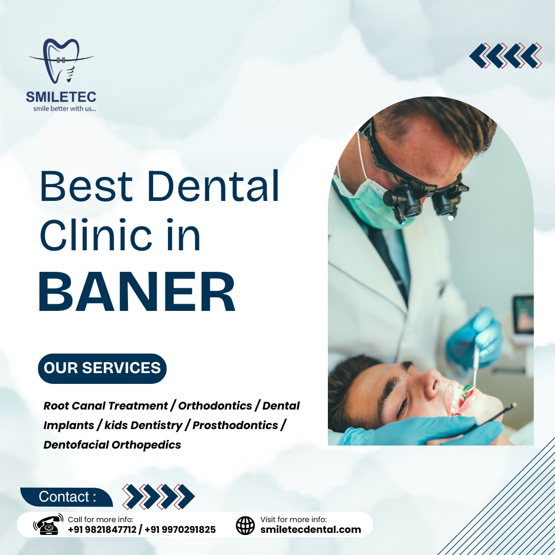 https://smiletecdental.com/best-dental-clinic-in-baner/
