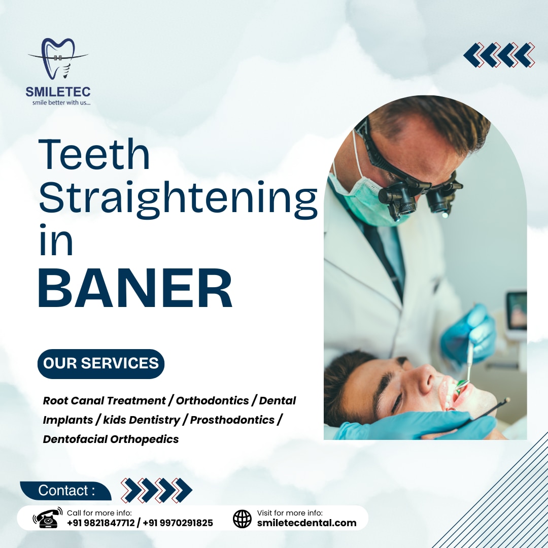 https://smiletecdental.com/teeth-straightening-in-baner/
