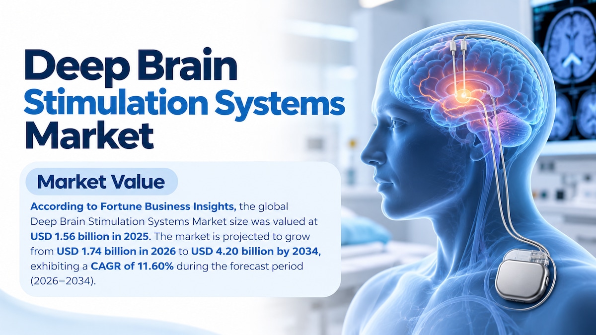 Deep Brain Stimulation Systems Market Size, Share, Growth Trends, Industry Analysis, and Forecast 20...