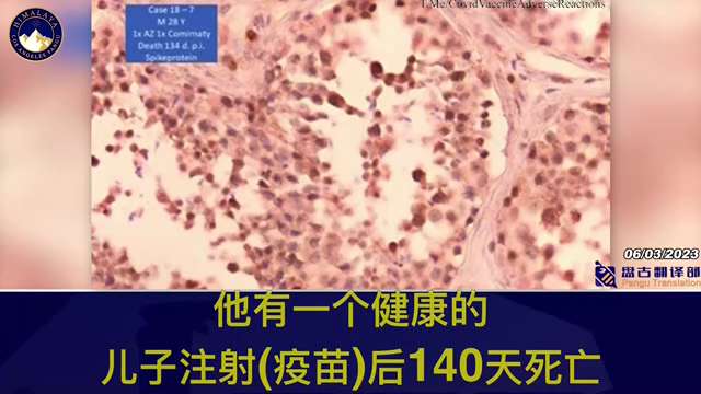 German pathologist Professor Arne Burkhardt has presented a disturbing slide showing that the spike ...