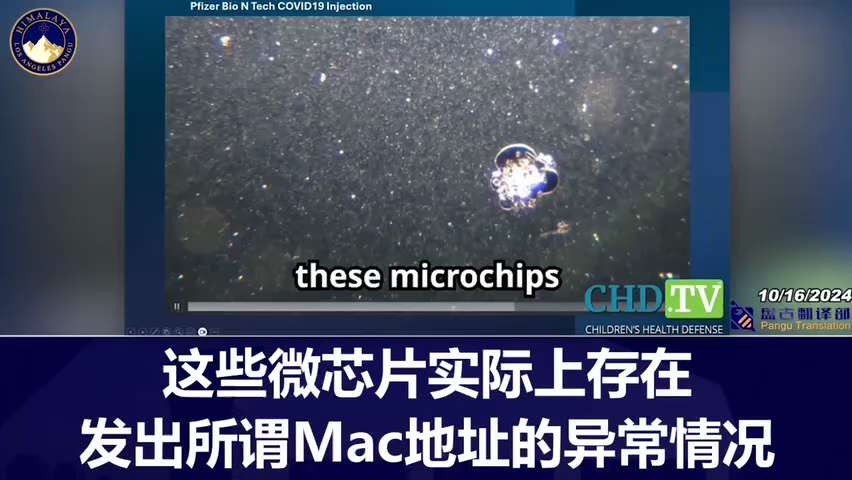 Dr. Ana Mihalcea used a 4000x microscope to examine the blood of people who received the COVID vacci...