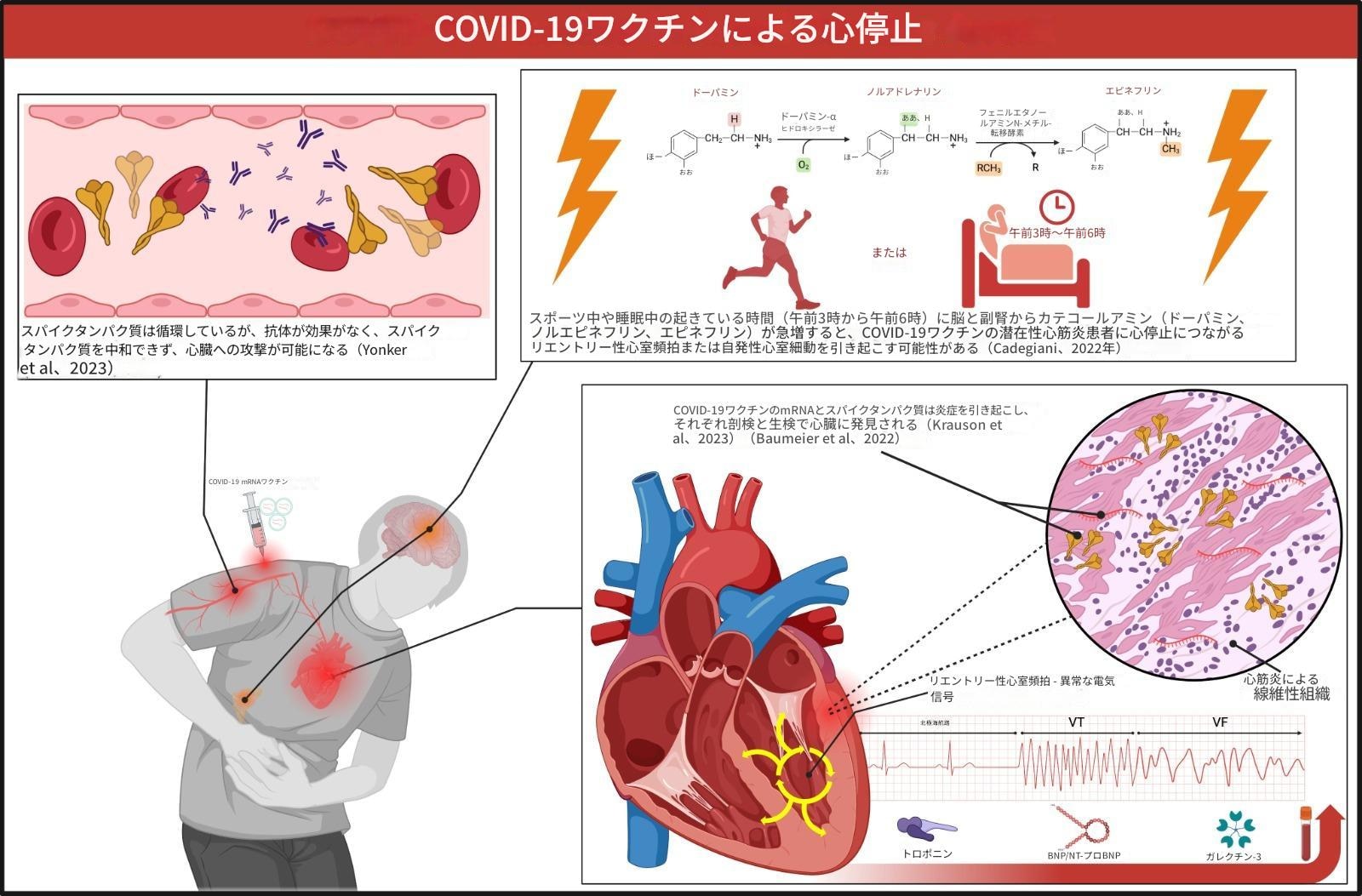 🚩COVID-19ワクチンによる心停止

🚩スパイクタンパク質は循環しているが、抗体が効果がなく、スパイクタンパク質を中和できず、心臓への攻撃が可能になる

🚩COVID-19ワクチンのmRNAとスパイクタンパク質は炎症を引き起こし、それぞれ剖検と生検で心臓に発見される 

🚩スポーツ中や睡眠中の起きている時間（午前3時から午前6時）に脳と副腎からカテコールアミン（ドーパミン、ノルエピネフリン、エピネフリン）が急増すると、COVID-19ワクチンの潜在性心筋炎患者に心停止につながるリエントリー性心室頻拍または自発性心室細動を引き起こす可能性がある
