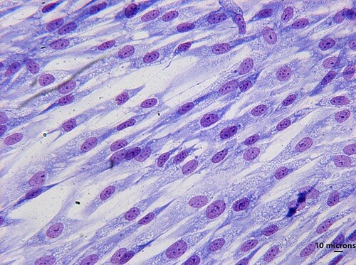 Human Osteoblasts Market to Soar Owing to Regenerative
Medicine Advances



Human osteoblasts, the s...