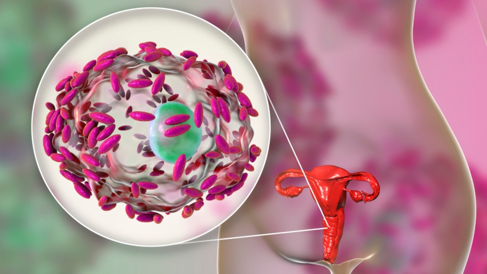 Bacterial Vaginosis Market Set to Surge with Next-Gen
Molecular Diagnostics



The Bacterial Vaginos...