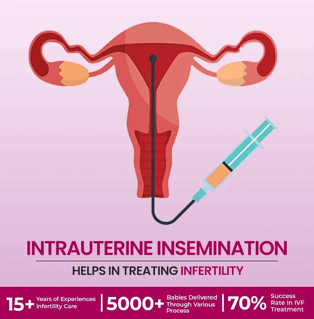 Urvara Fertility Centre in Lucknow provides advanced ICSI treatment to help couples facing male infe...