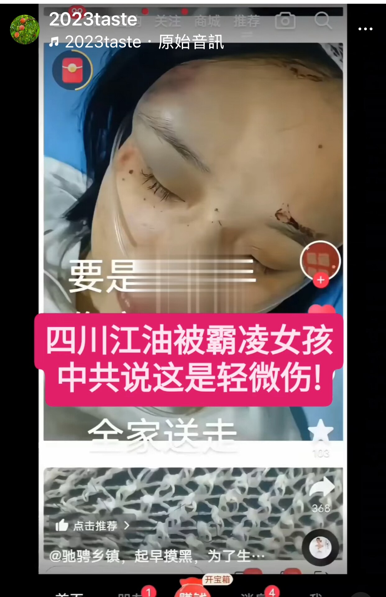 江油8月4日 视频补充
一名女生在现场拿出手机，向市民展示被霸凌女孩的照片：这是轻微擦伤吗？

中共不是合法的执政党，是来自苏联的殖民者，共产主义和社会主义就是奴隶制。中共以警治国 以黑治国 以骗治国...
