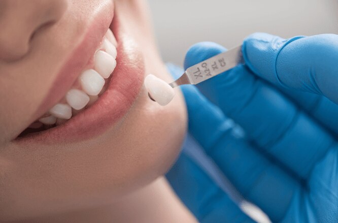 Nha khoa Nam Định: Cập nhật xu hướng chăm sóc răng miệng mới nhất cho người dân thành phố 

Trong nh...