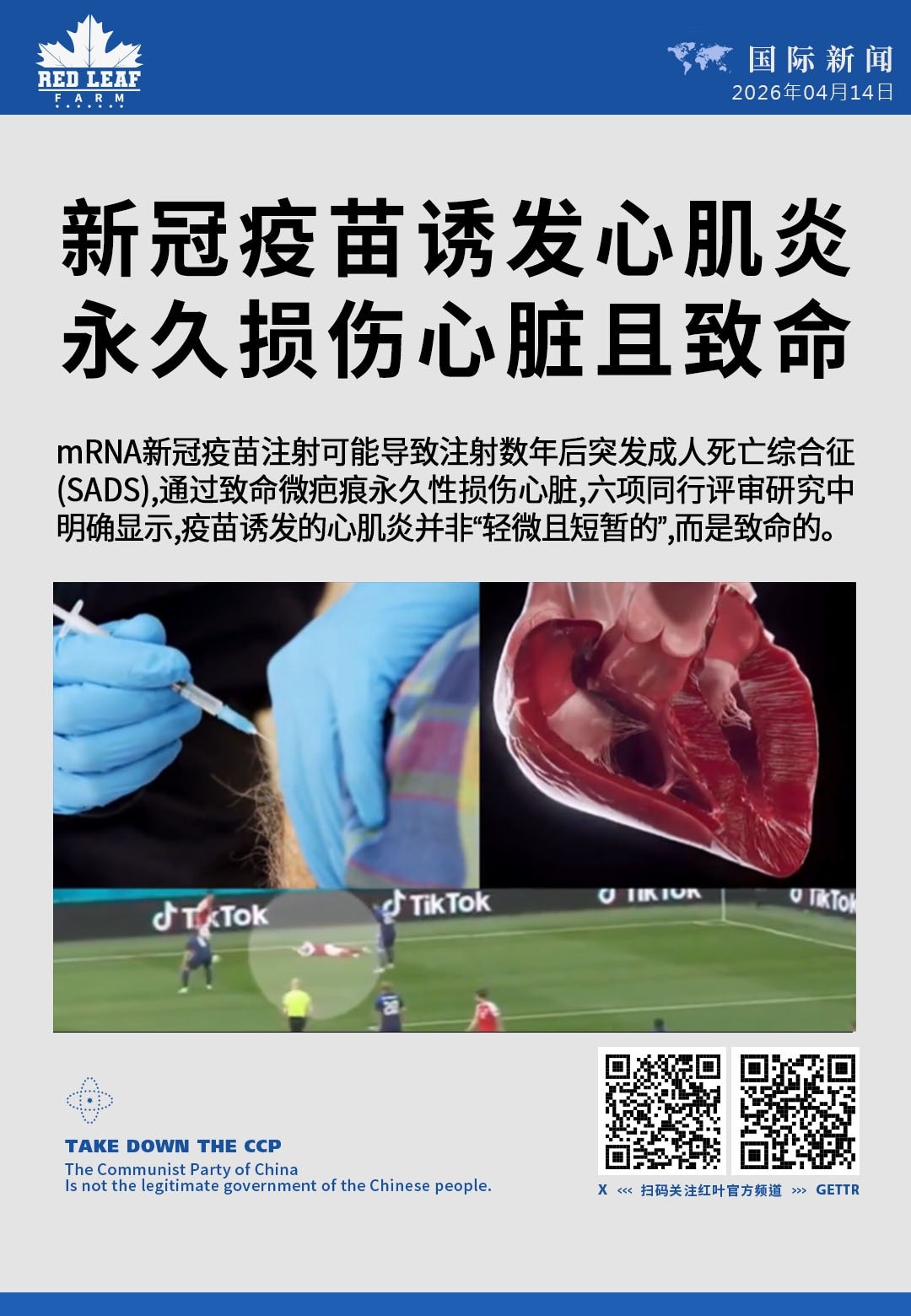 新冠疫苗诱发心肌炎 永久损伤心脏且致命

mRNA新冠疫苗注射可能导致注射数年后突发成人死亡综合征 (SADS)，通过致命微疤痕永久性损伤心脏。六项同行评审研究中明确显示，疫苗诱发的心肌炎并非“轻微且...