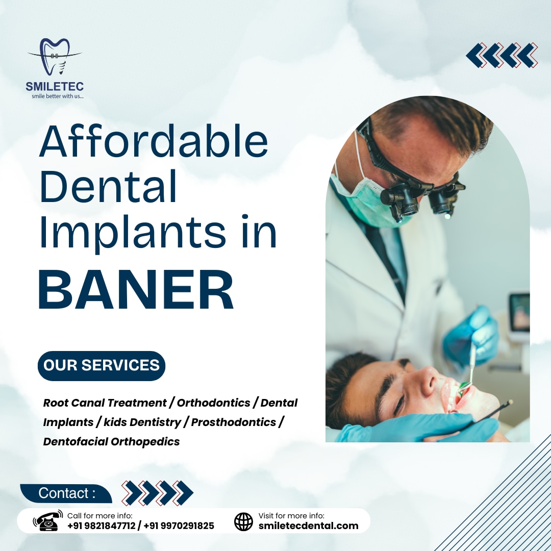 https://smiletecdental.com/affordable-dental-implants-in-baner/
