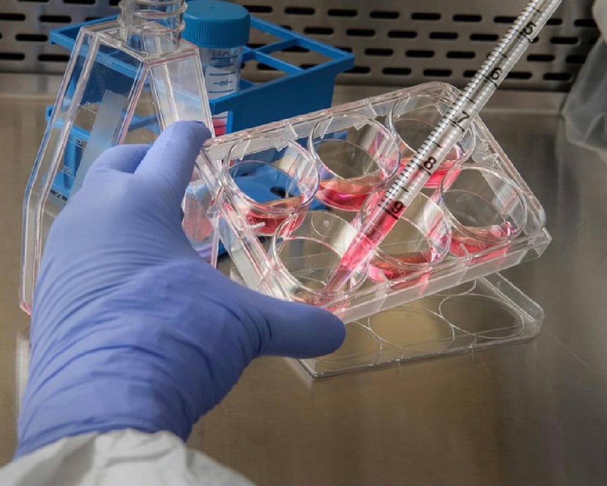 AMPLIADA COTA DE ISENÇÃO NA IMPORTAÇÃO DE INSUMOS PARA PESQUISAS EM 2022

A comunidade científica brasileira vai começar o ano de 2022 com uma boa notícia. Foi aprovado um aumento na cota de isenção para a importação de equipamentos e insumos voltados para a pesquisa científica e tecnológica no país. Um total de US$ 388.550.000,00 em isenção foi aprovado para o ano de 2022 e começa a valer a partir do dia primeiro de janeiro.

Terão direito à isenção, pesquisadores do Conselho Nacional de Desenvolvimento Científico e Tecnológico (CNPq ), entidade vinculada ao MCTI -  Ministério da Ciência, Tecnologia e Inovações , Instituições Científicas e Tecnológicas (ICTs) e empresas credenciadas ao CNPq/MCTI. 

Saiba mais em: gov.br/mcti