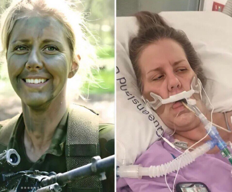 Before and after ONE Pfizer Shot 💉

Horrific.

