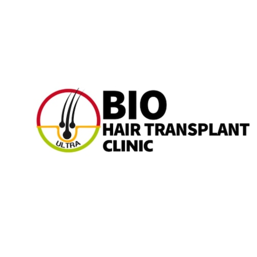 Ultra Bio Hair Transplant Clinic in Chennai, India provides the best hair treatment.