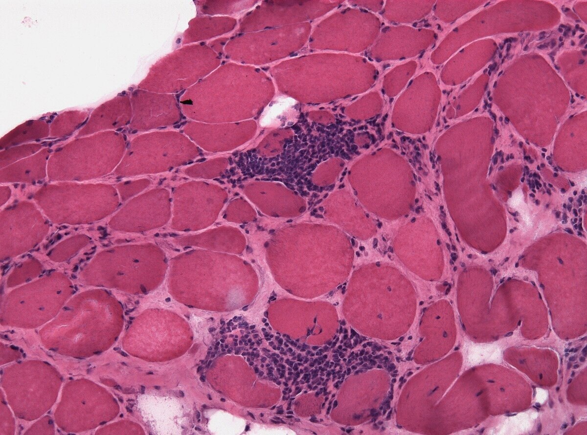 Inflammatory Myositis Diagnosis Market Booms with AI Analytics

 The Inflammatory Myositis Diagnosis...