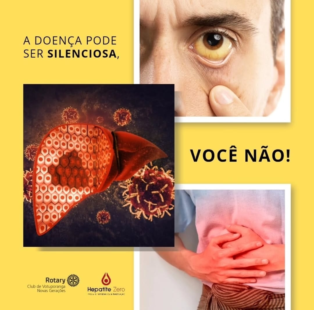 Julho Amarelo: o Rotary Club de Votuporanga - Novas Gerações reforça importância dos exames contra h...