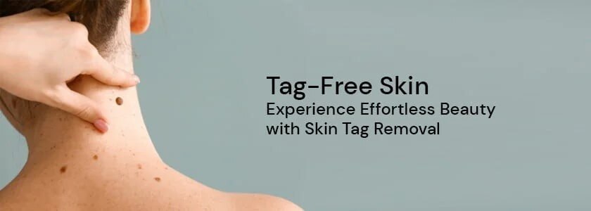  ▶▶✅100% Natural | ✅100% Effective | ✅100% Safe◀◀

The Science of Clear Skin: Understanding and Usin...