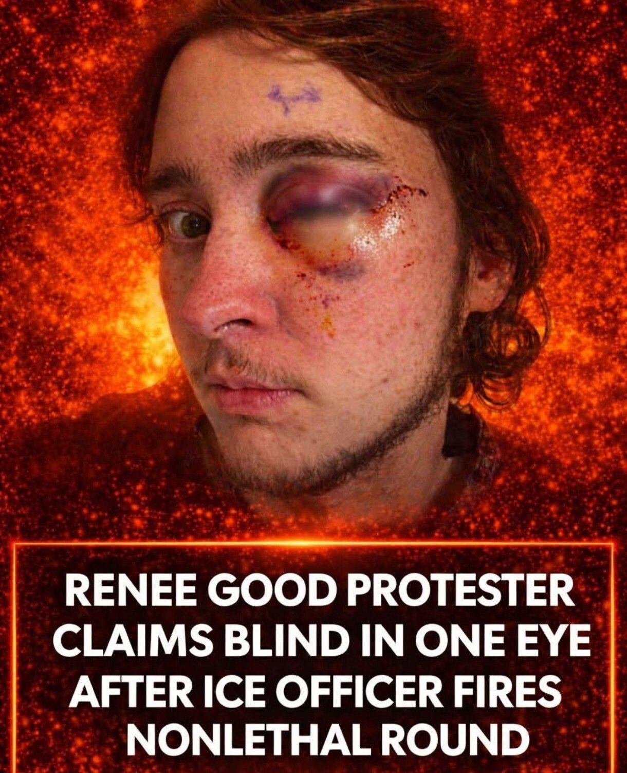 He definitely FAFO!A man who previously protested ICE raids — and spoke out about the Renee Good sho...