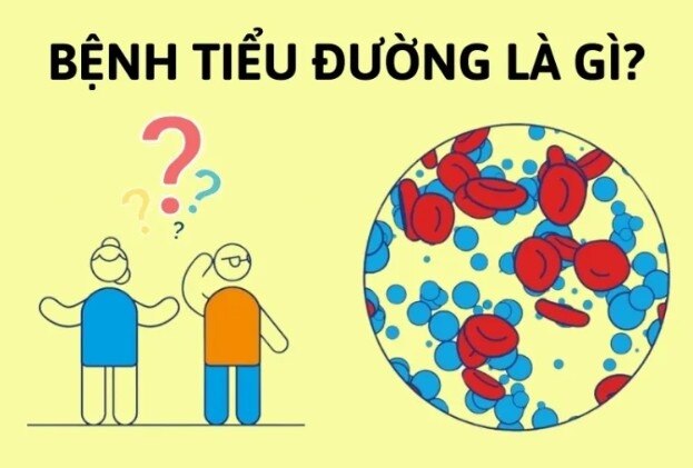 Biểu hiện của bệnh tiểu đường kéo dài ảnh hưởng chất lượng sống
Biểu hiện của bệnh tiểu đường không ...