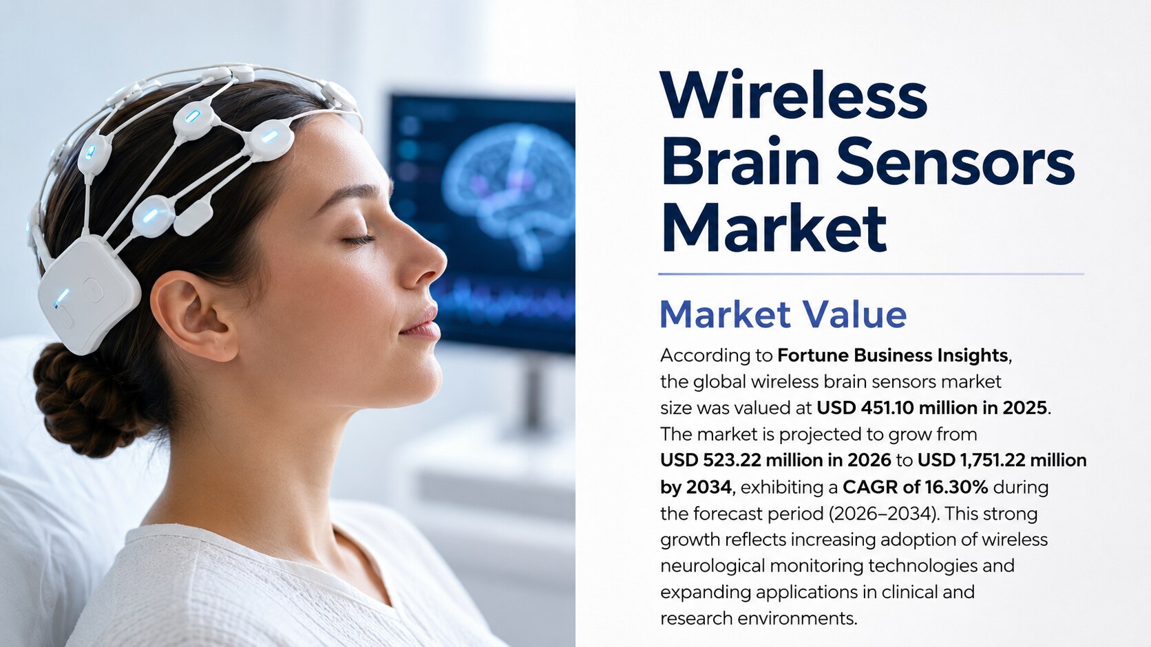 Wireless brain sensors market: size, trends, growth, and forecast (2026–2034)

According to Fortune ...