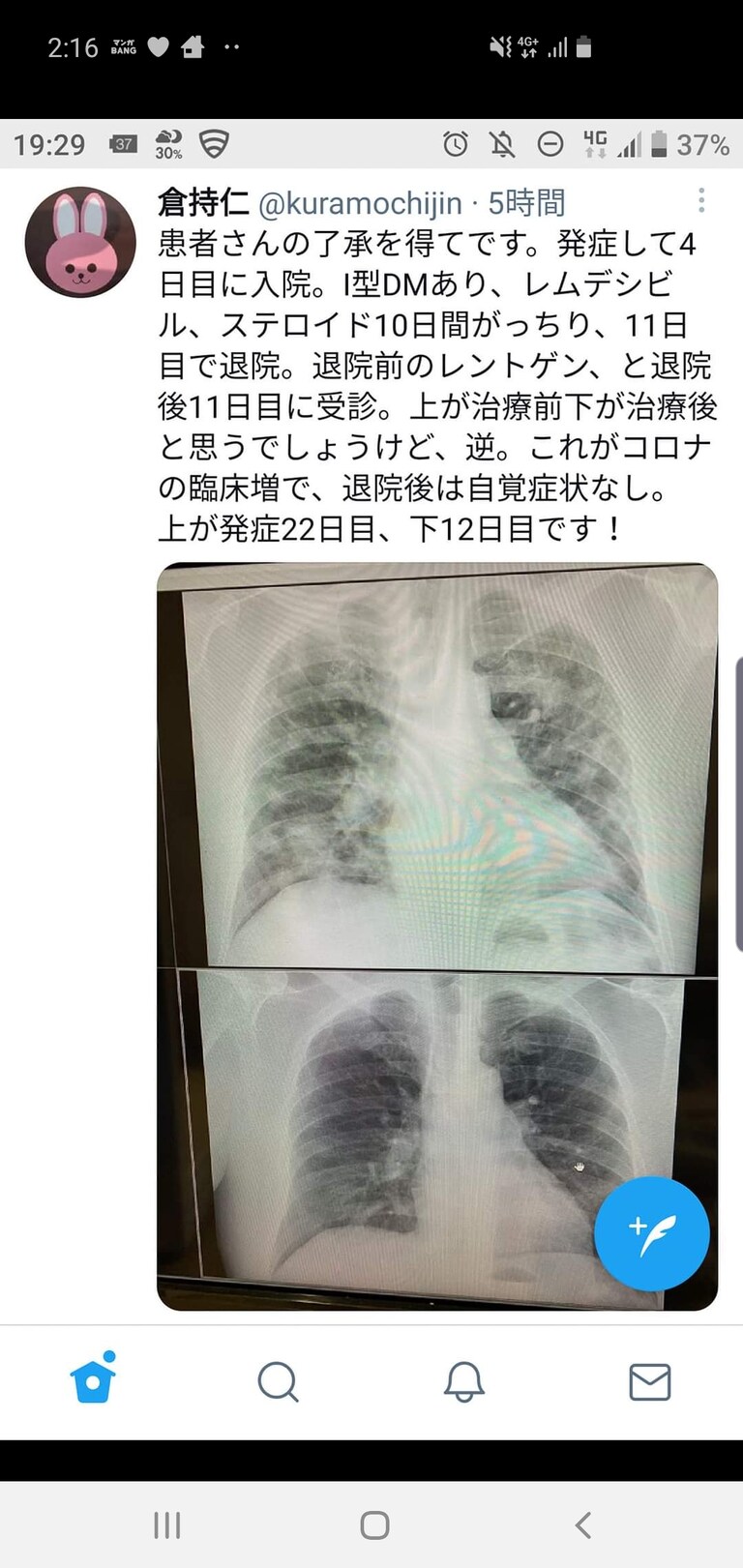 丸出しで医原病だな。
ま、どーでもいいけど。