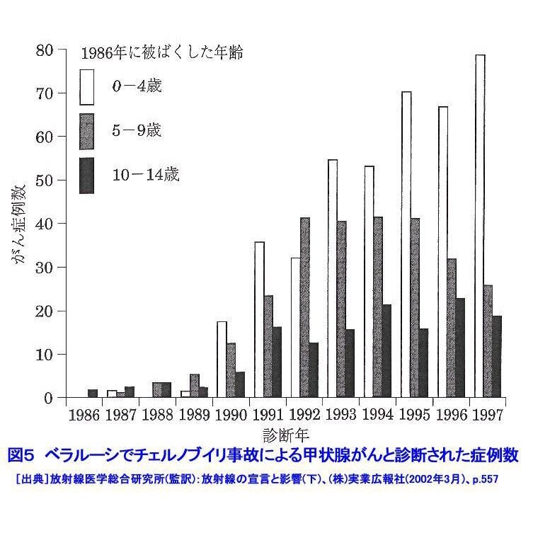 放射能内部被爆と発ガン

世界一被爆している日本、この結果どのようなことが起こるか、まだ人々は把握していないようである。

アメリカの予防医療作業部会は40代の定期検診にマンモグラフィーを勧めていない...