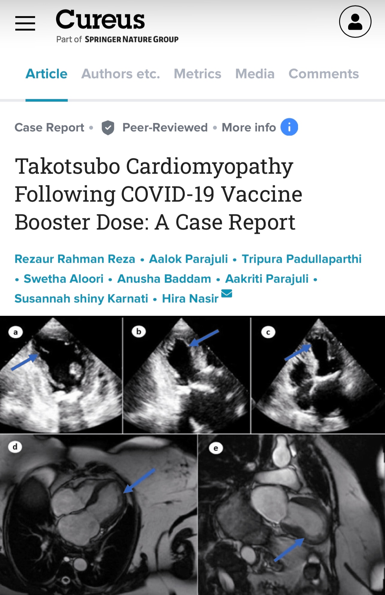 🚨 New Report Reveals an Unexpected COVID Vaccine Side Effect: ‘Ballooning of the Heart’

“COVID-19 ...