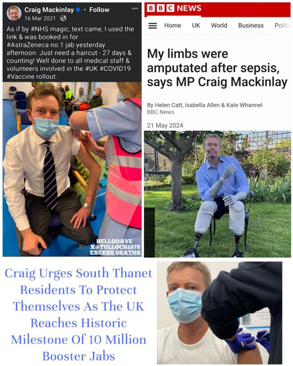 保守党议员克雷格·麦金莱 (Craig Mackinlay) 的手脚被截肢。

“就像#NHS魔法一样，短信来了，我使用链接并预定了昨天下午#AstraZeneca第一次 JAB。”
#疫苗災難  #疫苗与病毒真相  
#疫苗徘毒
bbc.com/news/uk-politi…