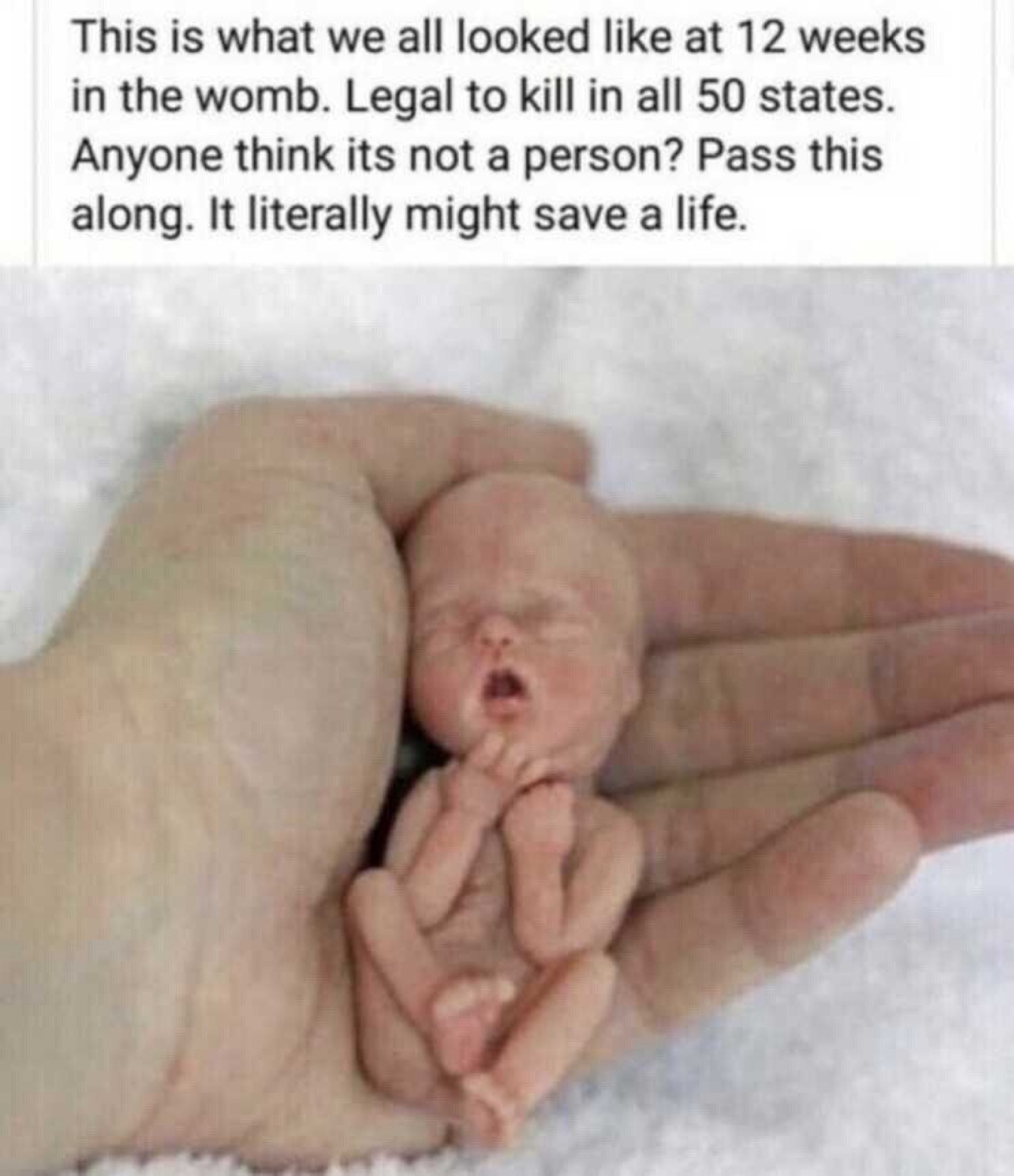 Just Saying!🤔😎How could anyone kill the innocent as this😢