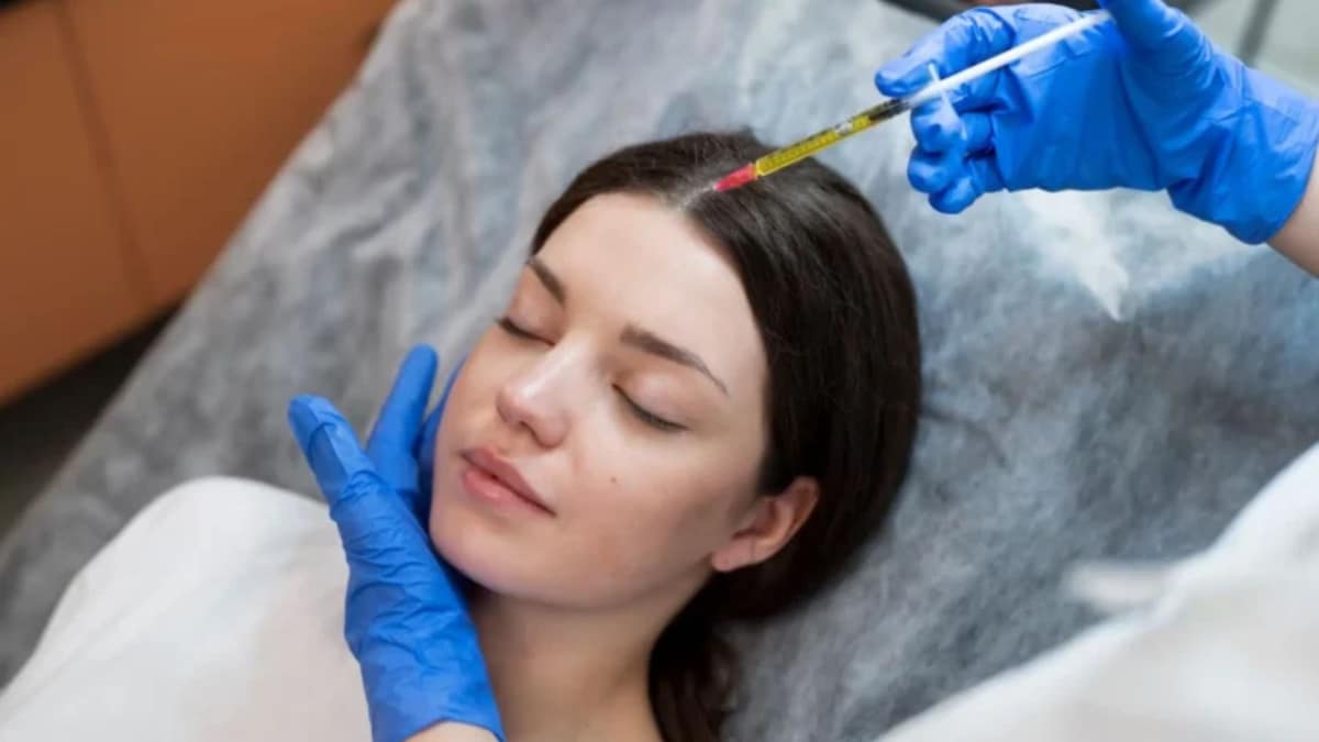 PRP Microneedling: Natural Skin Rejuvenation Guide

Platelet-rich plasma (PRP) Microneedling, common...