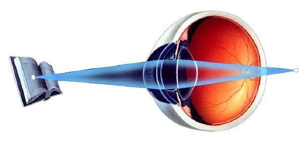 Presbyopia Treatment Market to Soar with Novel Pharmacological Solutions


 In the evolving healthca...
