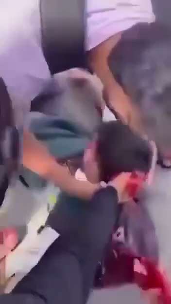 9月9日，尼泊尔，一名抗议者被子弹击中头部，一群他的同伴抬着他去就医，血腥警告。
