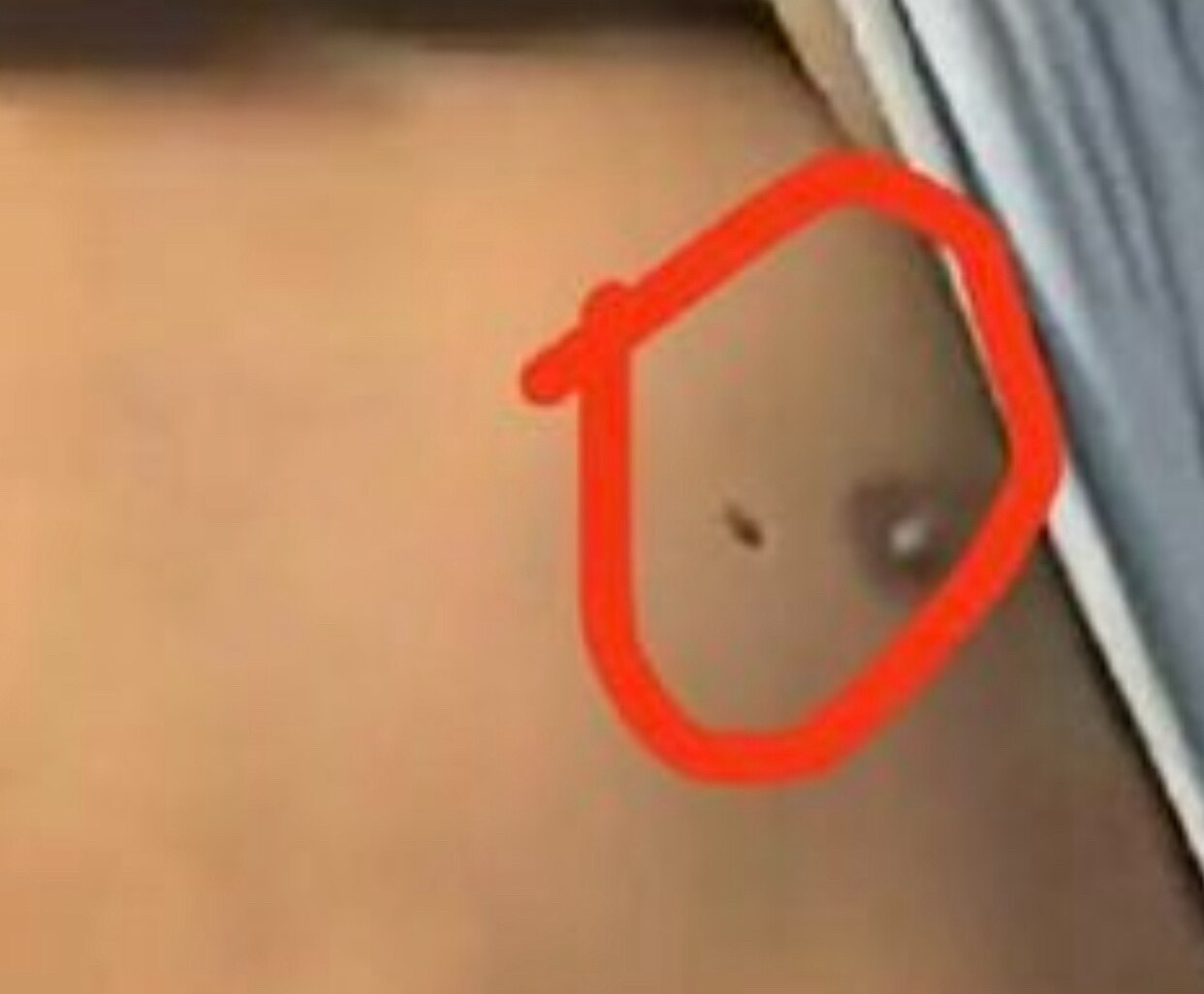 这些邪恶的医生太邪恶了 怎么下得去手， 对15 岁小孩 心脏扎进去