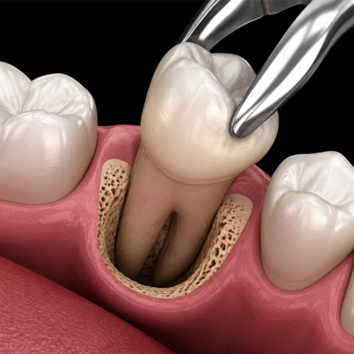 My goal is to make dental topics easier to understand while highlighting the importance of professional treatment.