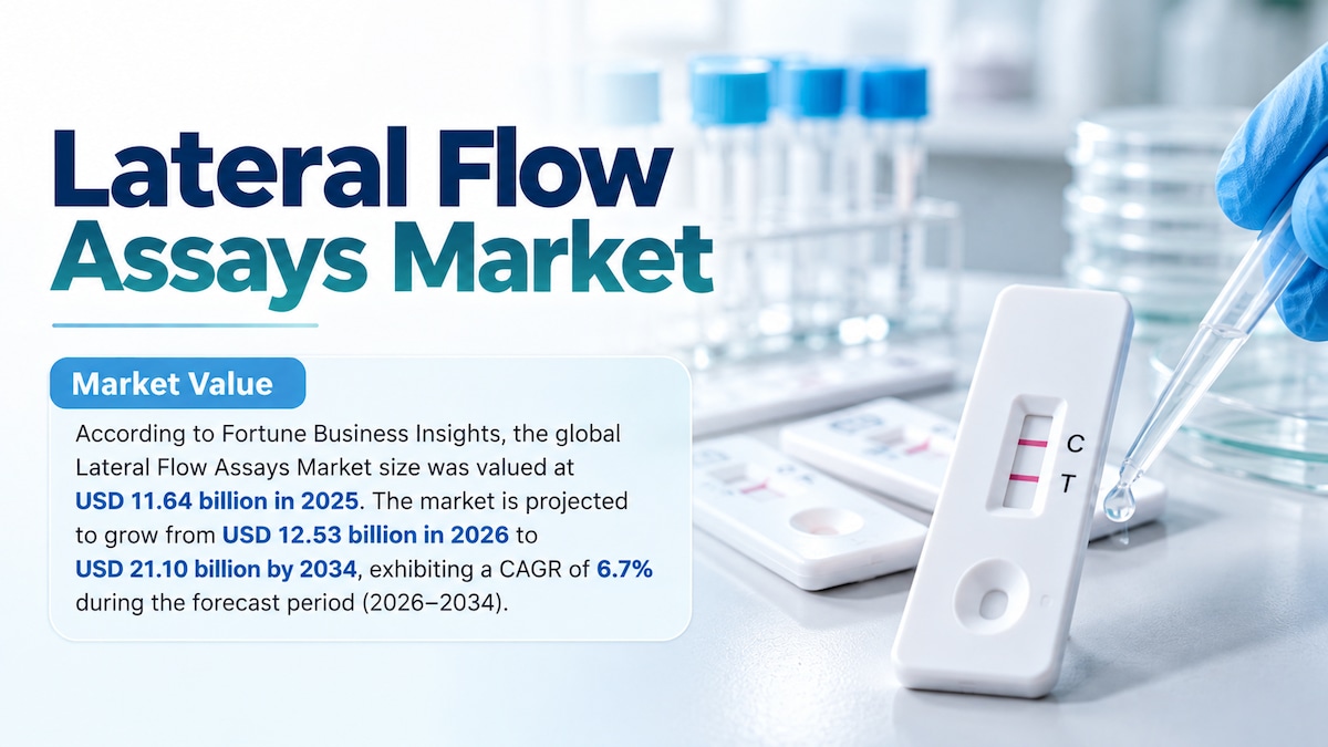 Lateral Flow Assays Market Size, Share, Growth Trends, and Future Outlook 2026–2034

According to Fo...