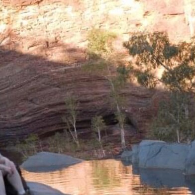 @drnaomirwolf One other thing to note from the study is that the 50 micrograms affected the female group but not t...