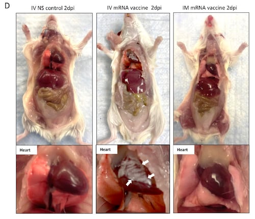 More on jab LNP Heart damage, causing Myocarditis and Pericarditis. 
"Moreover, smaller mRNA-vaccine lipid-nanoparticles (100nm diameter) can be sucked into larger T tubules (diameter &gt;200 nm) of cardiomyocytes during diastole, but not into T tubules of skeletal myocyte (diameter 20–40 nm) [36]. Thus, the T tubule system of cardiomyocytes may concentrate mRNA-vaccine lipid-nanoparticles like a sponge." 
Representative images of gross pathology of mouse organs including heart at 2 dpi. Large whitish patches (arrows) were seen on the visceral pericardium of mice receiving IV vaccine. Abbreviations: COVID-19, coronavirus disease 2019; dpi, days post-injection; mRNA, messenger RNA.
https://watermark.silverchair.com/ciab707.pdf